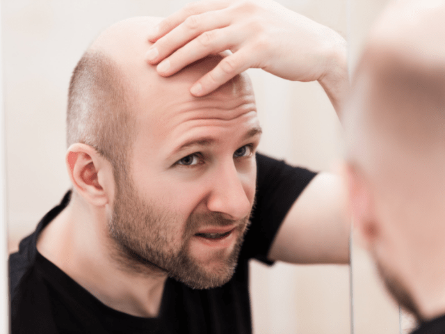 bald man scratching is head in front of a mirror